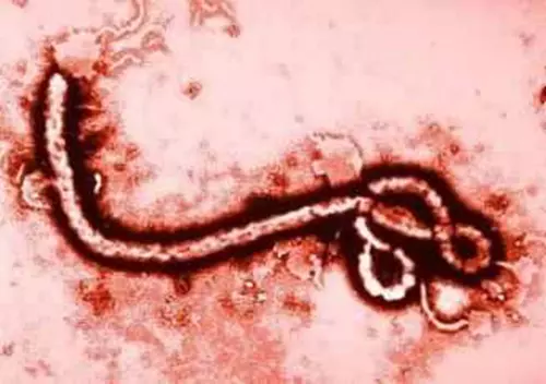A 2014-es Ebola-j�rv�ny az eddigi legs�lyosabb